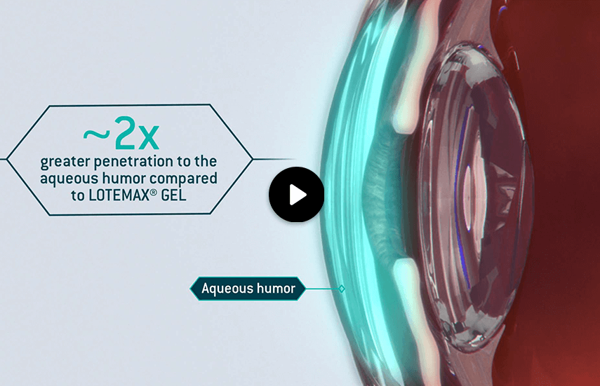 LOTEMAX SM: Method of Delivery Icon