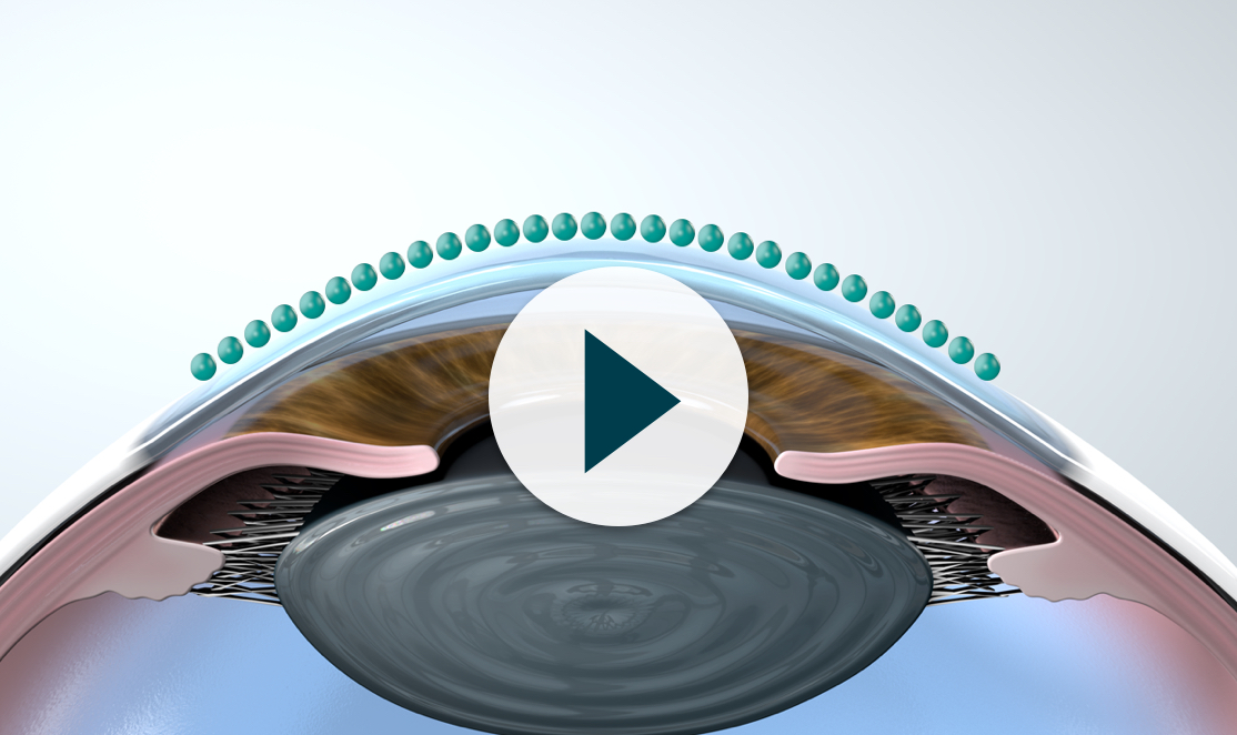 SM Technology Efficient Absorption Video